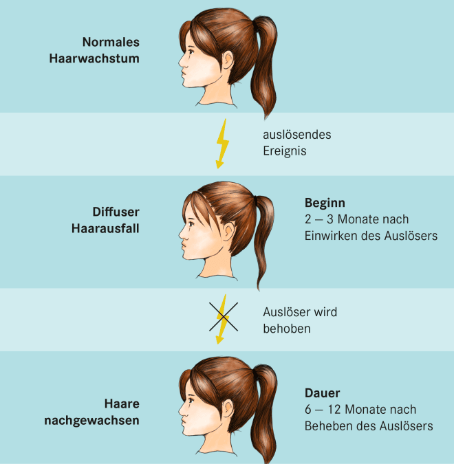 Diffuser Haarausfall: Ursachen und Therapie
