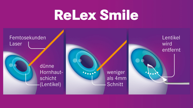 künstliche wimpern auftragen Premium Lash Applikator für falsche Wimpern von Lashkitti® – Wimpanista