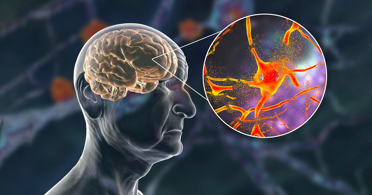Forschung-Stammzellen-k-nnten-Parkinson-Symptomen-lindern