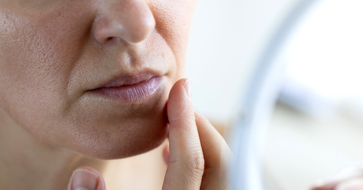 Abnehm-Ph-nomen-Ozempic-Face-Gesichtsver-nderung-vorbeugen