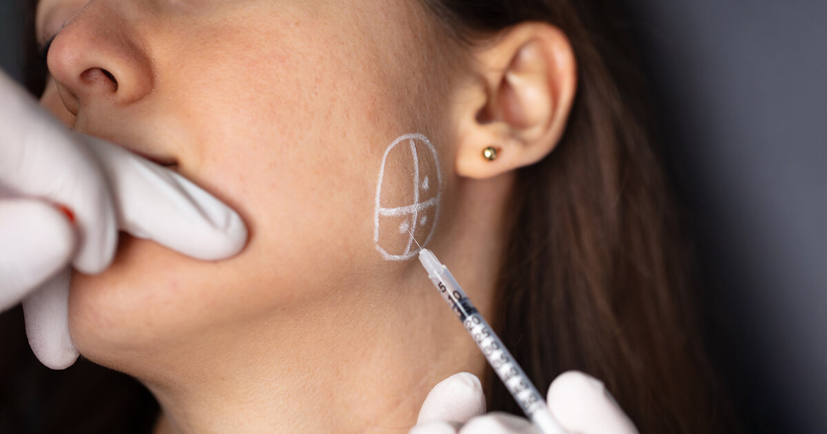 Bruxismus-Was-bringt-Botox-gegen-Z-hneknirschen-