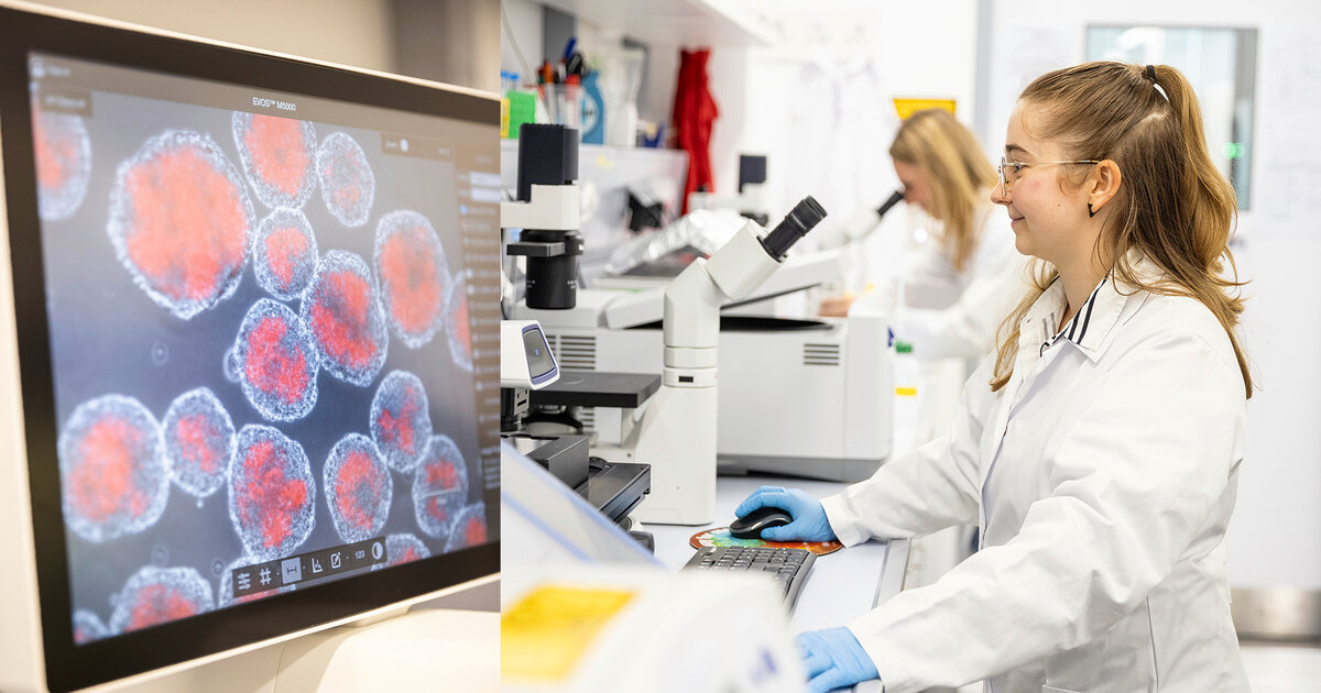 Wie-Zellen-aus-dem-Labor-k-nftig-Typ-1-Diabetes-heilen-k-nnten