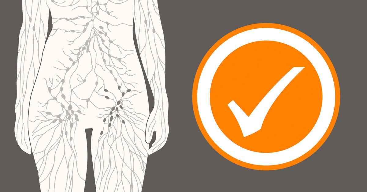 Geschwollene-Lymphknoten-in-der-Leiste