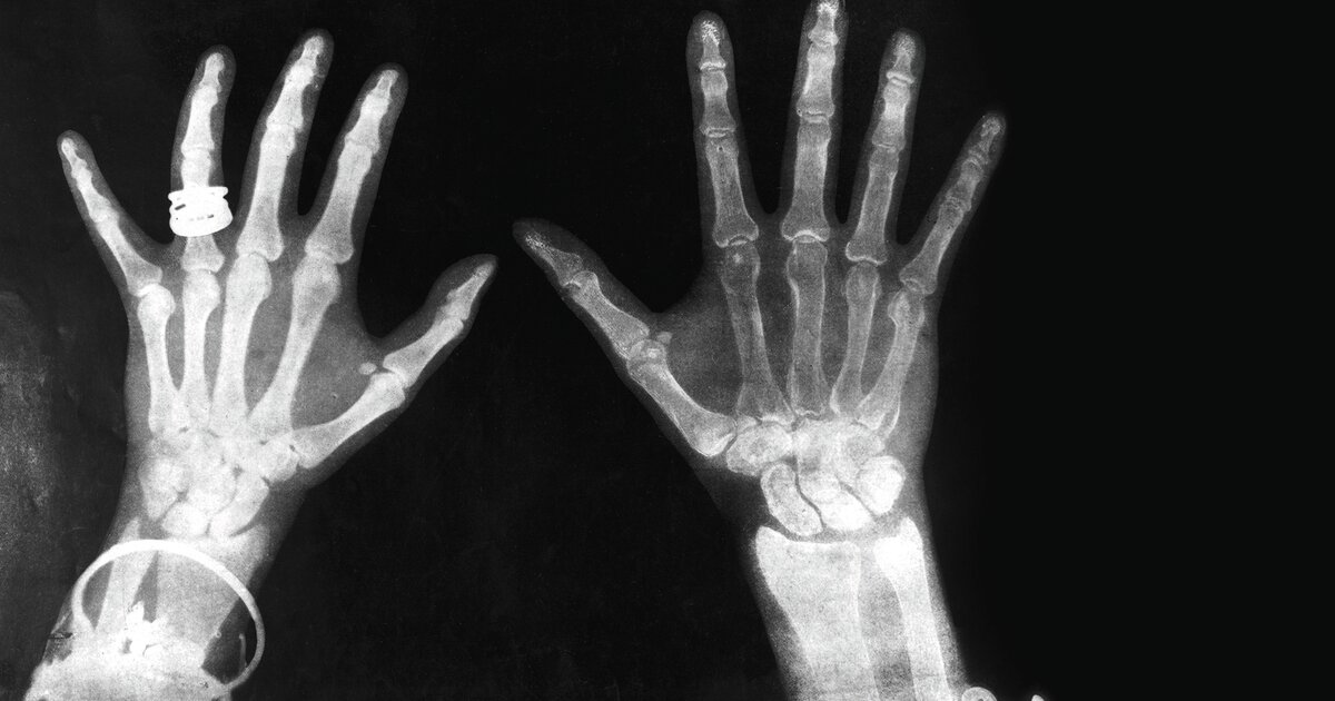 Wie-der-Blick-in-den-K-rper-die-Medizin-revolutionierte