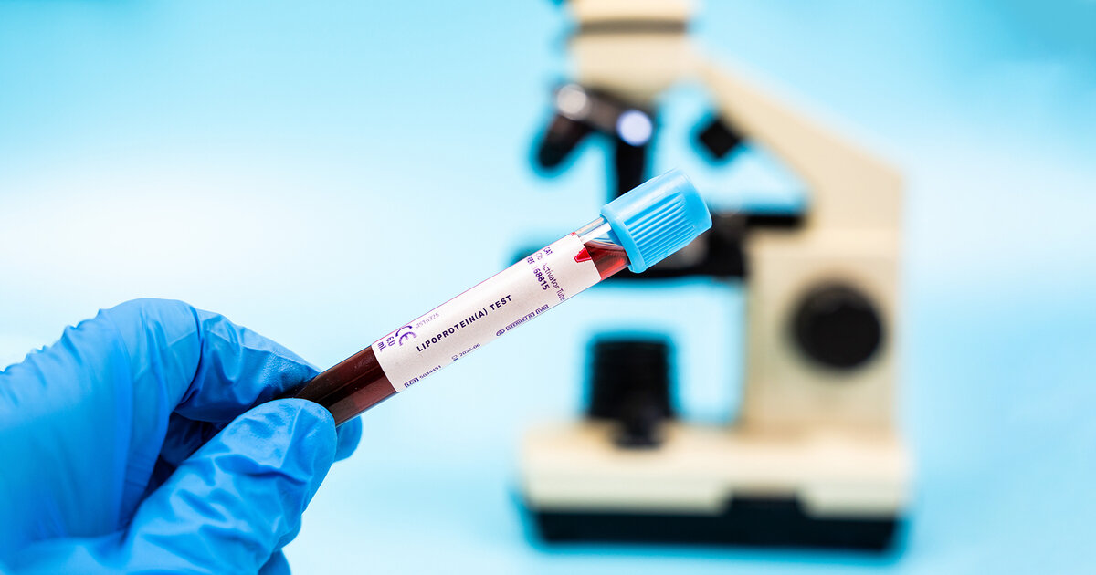 Blutwerte-Welche-wichtig-sind-und-welche-nicht