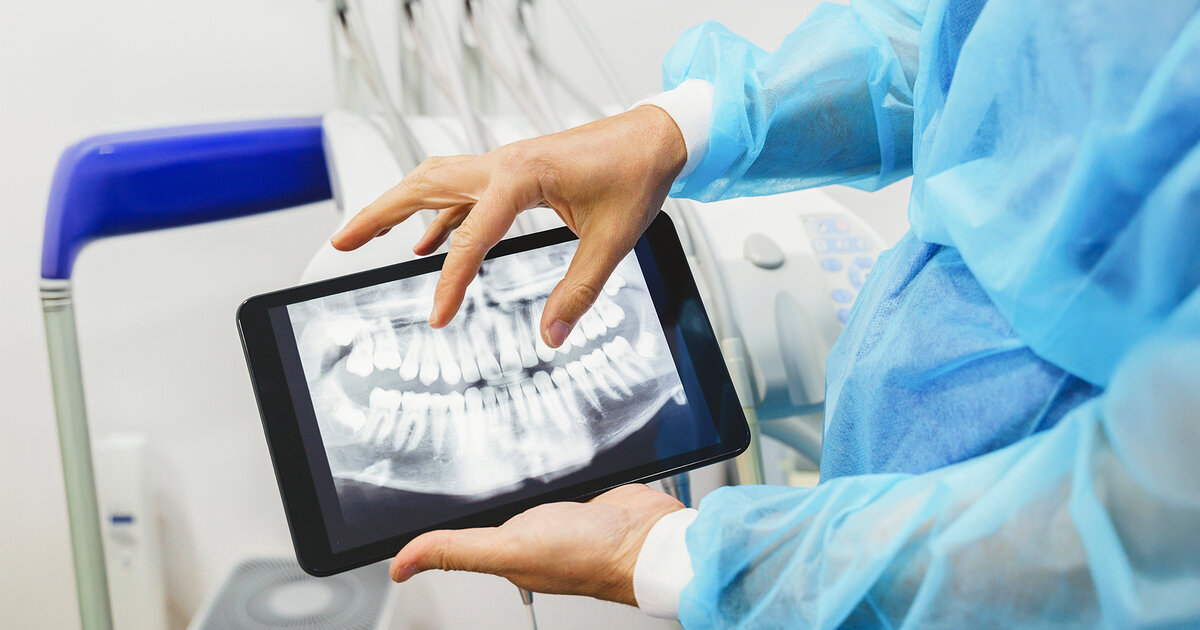 Wie-Sie-die-Tage-nach-einer-Weisheitszahn-OP-gut-berstehen