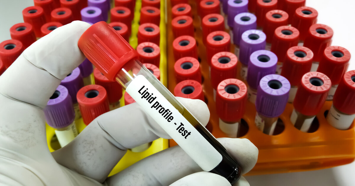 Lipidsenker-erkl-rt-Wann-die-Cholesterinsenker-n-tig-sind