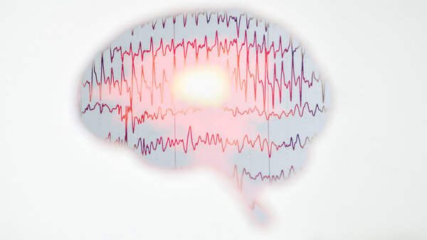 Epileptischer Anfall Im Schlaf Tod www.apotheken-umschau.de