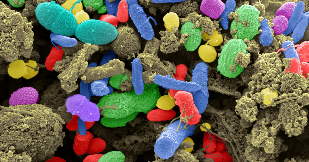 Welche-Funktion-hat-das-Darm-Mikrobiom-wie-h-lt-man-es-gesund-