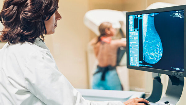 Was Passiert Wenn Die Mammographie Auffällig Ist