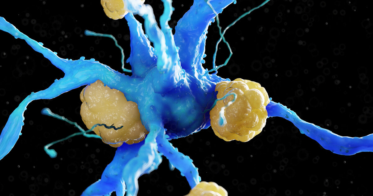 Lecanemab-bei-Alzheimer-wie-es-wirkt-wer-es-bekommen-kann