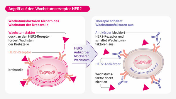 APREPITANTratiopharm 125 mg/80 mg Hartkapseln Beipackzettel