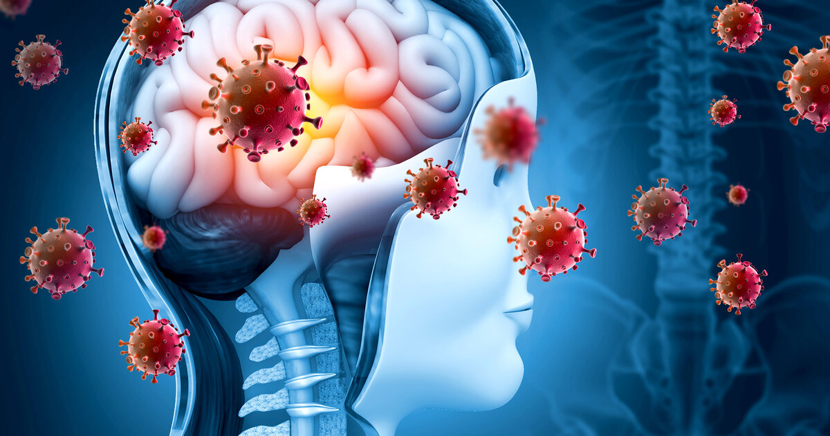 Gehirnhautentz-ndung-Meningitis-Symptome-und-Therapie