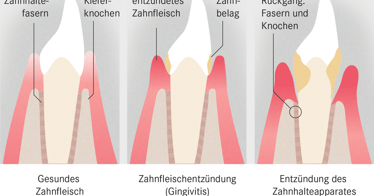 darf man e zigaretten mit ins flugzeug nehmen Darf man Einweg-E-Zigaretten ins Flugzeug mitnehmen? Wie lauten die Regeln  und Vorschriften?