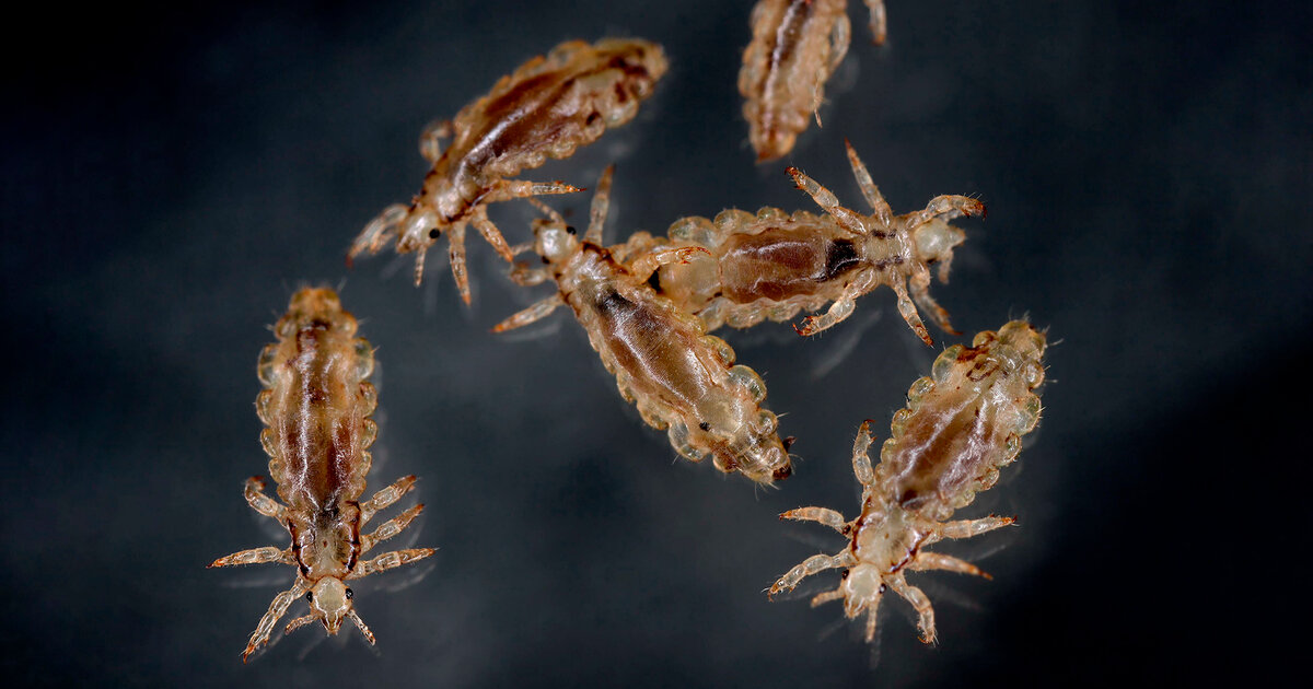 Wenn-s-am-Kopf-juckt-L-use-erkennen-und-behandeln