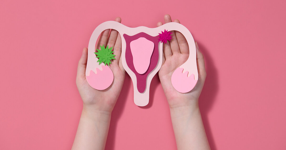 Eierstockkrebs-Ovarialkarzinom-