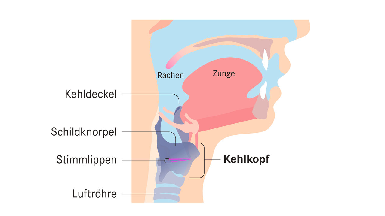 Was tun bei einer Kehlkopfentzündung? | Apotheken Umschau