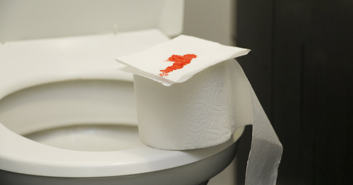 Frisches Blut Am Toilettenpapier Nach Stuhlgang Schwangerschaft
