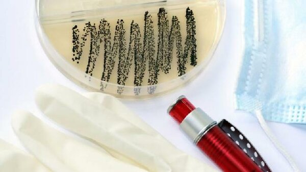 Bakterien Im Urin Aber Keine Blasenentzündung www.apotheken-umschau.de